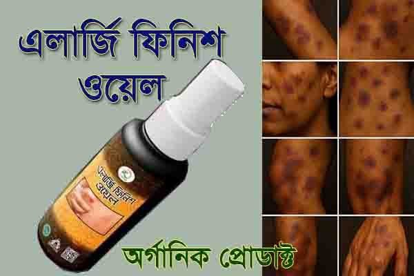 এলার্জি ফিনিশ ওয়েল – প্রাকৃতিক উপায়ে এলার্জির স্থায়ী সমাধান!